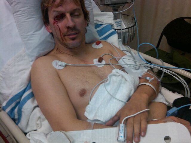 Phil Laak hospitalizovan nakon nesreće na četvorotočkašu 101
