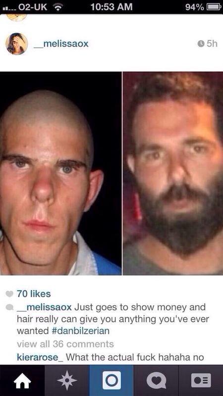 Tweet Tweet Bad Beat - De ALS Ice Bucket Challenge, en een kale Dan Bilzerian 101