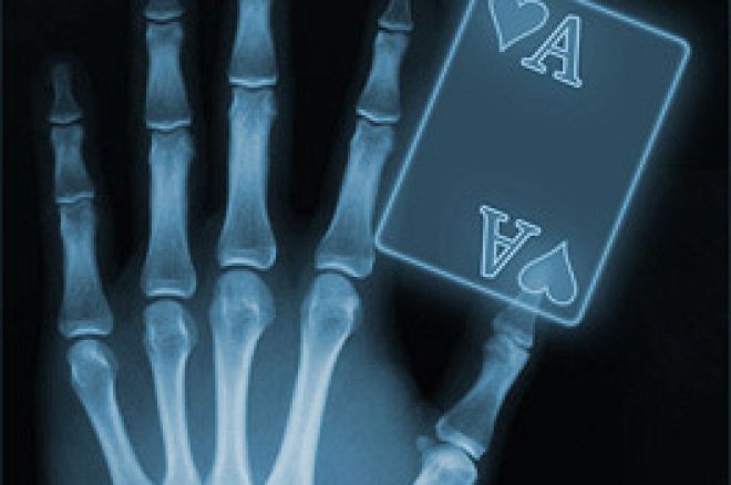 De anatomie van een hand 0001 De anatomie van een hand 0001